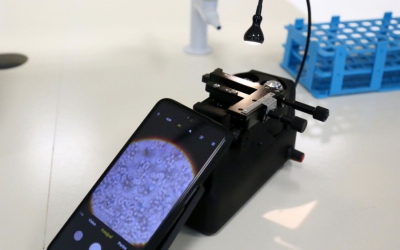 Mobil mikroskop, hayat kurtaracak